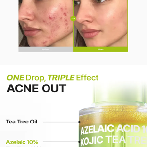 Purito Azelaic Acid 10% + Kojic Acid + Tea Tree Facial Serum